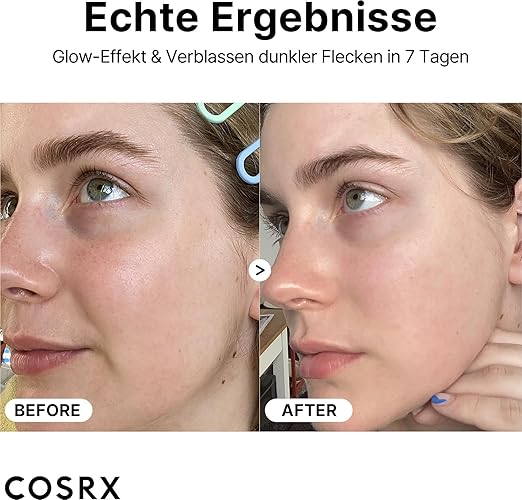 COSRX Reines Vitamin C 23% Serum mit Vitamin E (Ascorbinsäure) und Hyaluronsäure, feuchtigkeitsspendendes Gesichtsserum, reduziert feine Linien, 0,70 fl.oz (20 g (1 Stück))